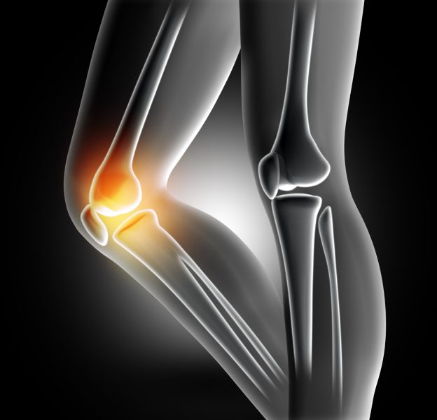 pain-knee-joint